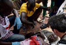Scène de crise humanitaire au Soudan du Sud avec visage anonymisé