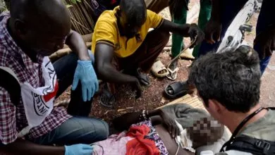 Scène de crise humanitaire au Soudan du Sud avec visage anonymisé