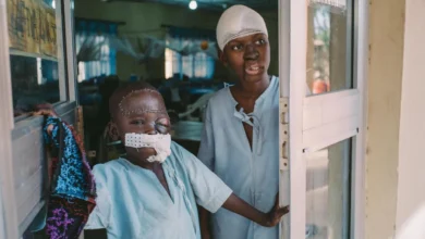 Noma maladie négligée qui dévaste les enfants dans le nord du Nigeria