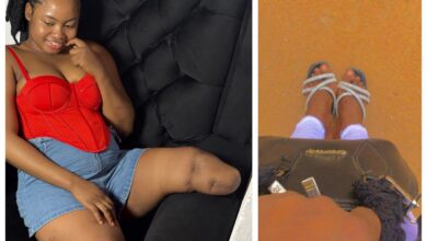 « J’aurais aimé rester chez moi ce jour-là » – une Nigériane qui a perdu ses deux jambes dans un accident partage ses regrets