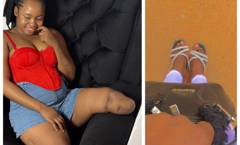 « J’aurais aimé rester chez moi ce jour-là » – une Nigériane qui a perdu ses deux jambes dans un accident partage ses regrets
