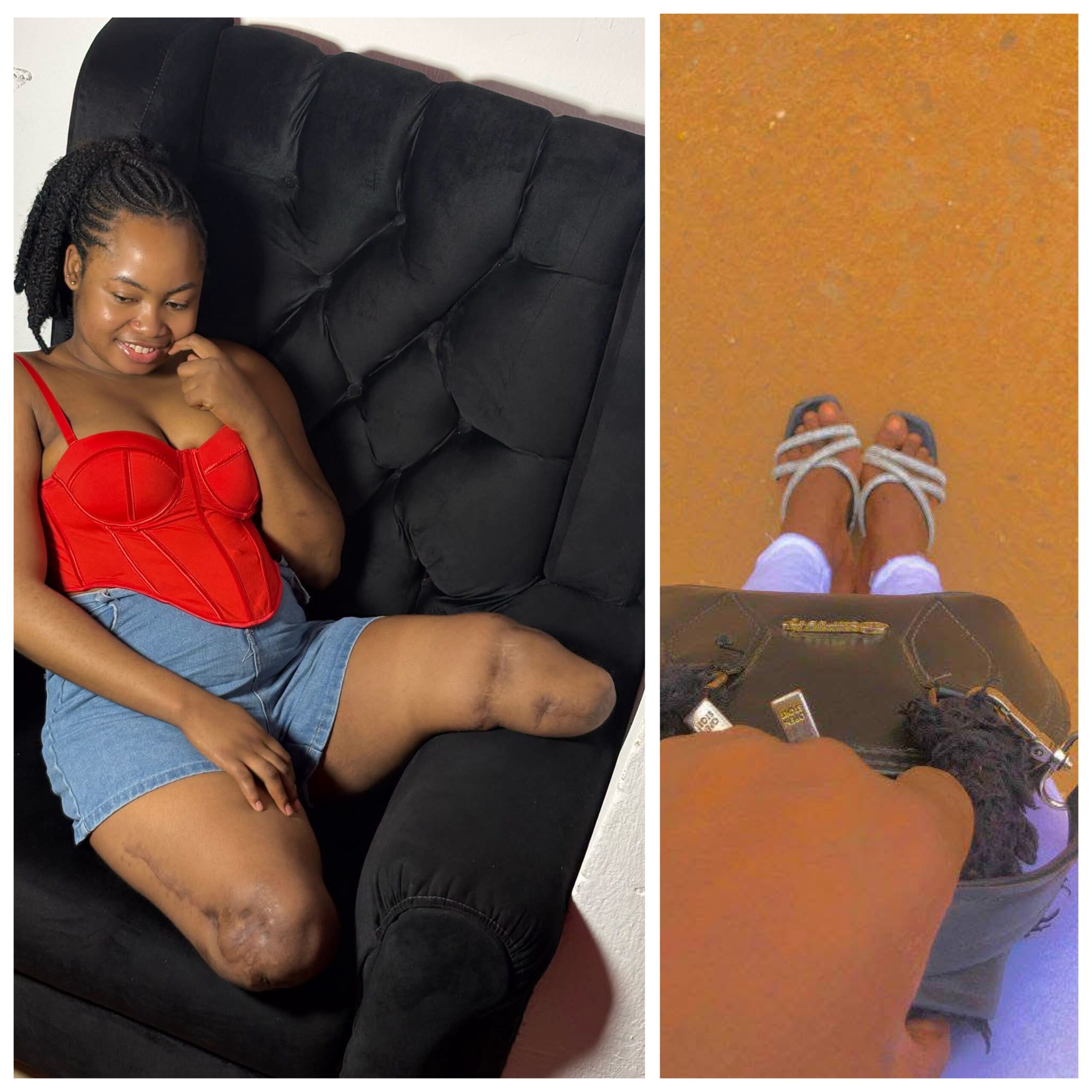 « J’aurais aimé rester chez moi ce jour-là » : une Nigériane qui a perdu ses deux jambes dans un accident partage ses regrets